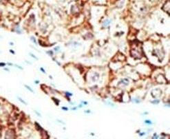 Ubiquilin 1 Antibody in Immunohistochemistry (IHC)