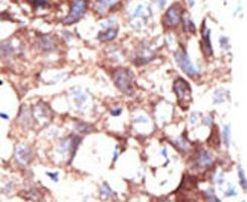 Ubiquilin 1 Antibody in Immunohistochemistry (IHC)