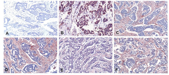 Urokinase Antibody in Immunohistochemistry (IHC)