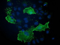 VASP Antibody in Immunocytochemistry (ICC/IF)