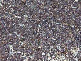 VBP1 Antibody in Immunohistochemistry (Paraffin) (IHC (P))