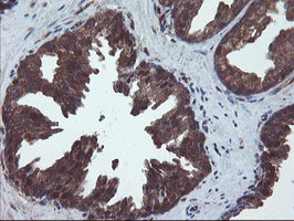VBP1 Antibody in Immunohistochemistry (Paraffin) (IHC (P))