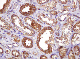 VBP1 Antibody in Immunohistochemistry (Paraffin) (IHC (P))