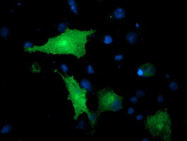 VCAM1 Antibody in Immunocytochemistry (ICC/IF)