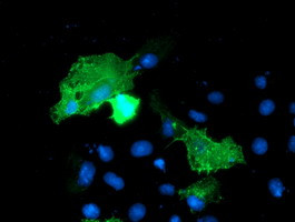 VCAM1 Antibody in Immunocytochemistry (ICC/IF)