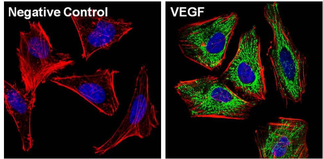 VEGF Antibody in Immunocytochemistry (ICC/IF)