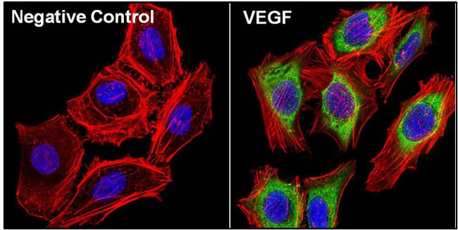 VEGF Antibody in Immunocytochemistry (ICC/IF)