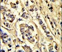 VEGF Receptor 2 Antibody in Immunohistochemistry (IHC)