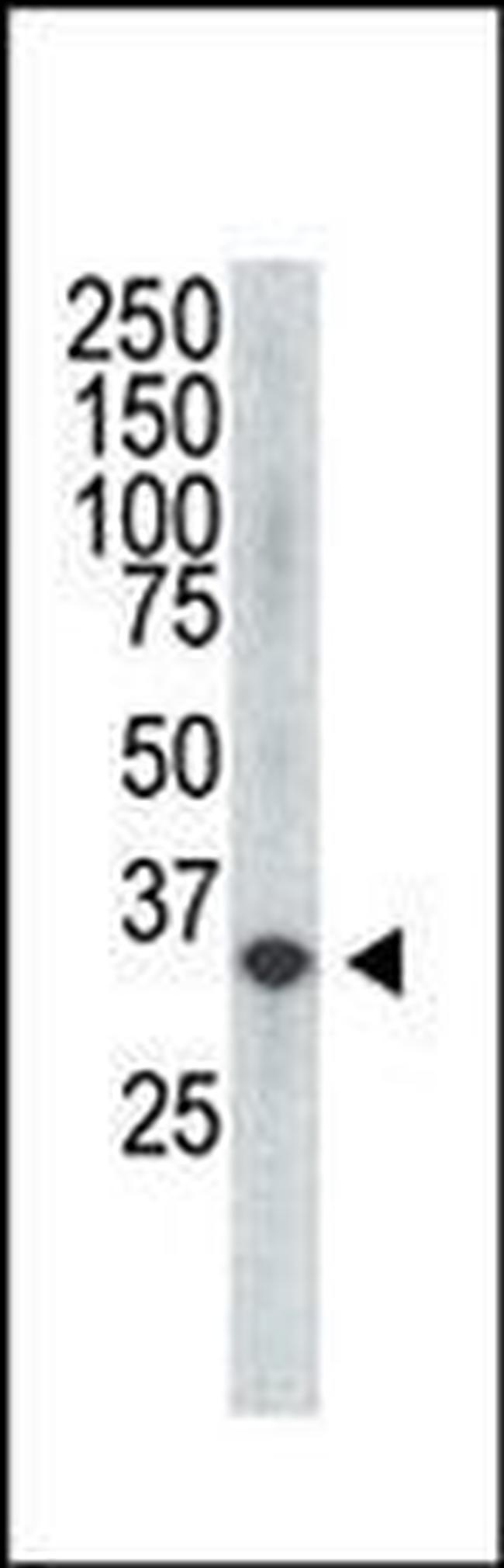 VEGFD Antibody in Western Blot (WB)