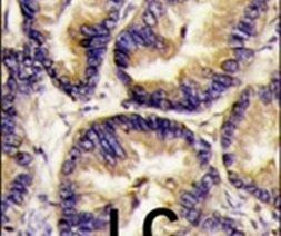 VEGFB Antibody in Immunohistochemistry (IHC)
