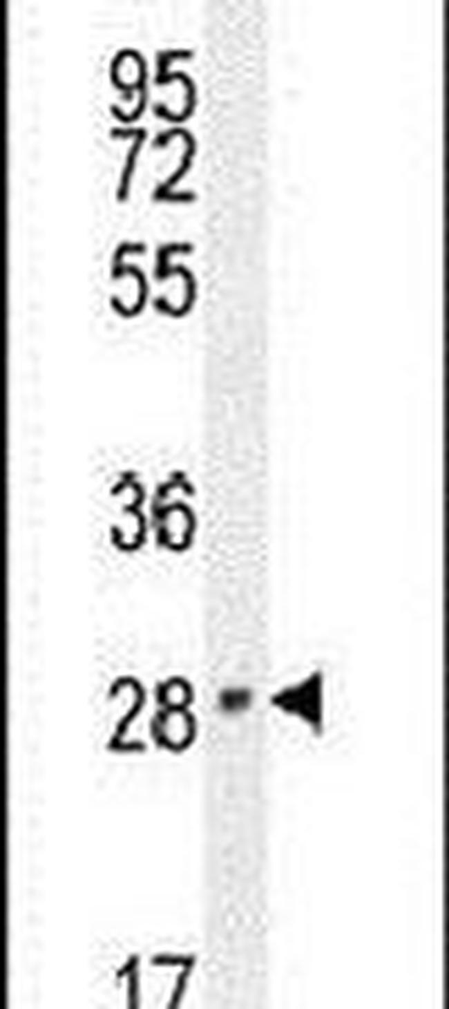 VGLL2 Antibody in Western Blot (WB)