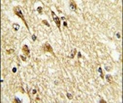 VGLUT2 Antibody in Immunohistochemistry (IHC)