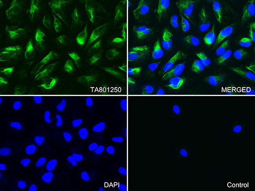 VIM Antibody in Immunocytochemistry (ICC/IF)