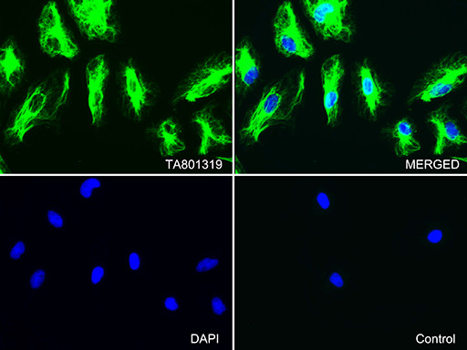 VIM Antibody in Immunocytochemistry (ICC/IF)