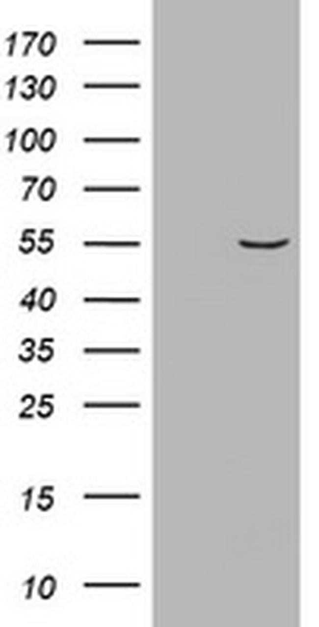 VIM Antibody in Western Blot (WB)