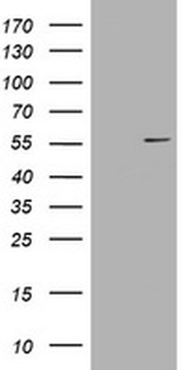VIM Antibody in Western Blot (WB)
