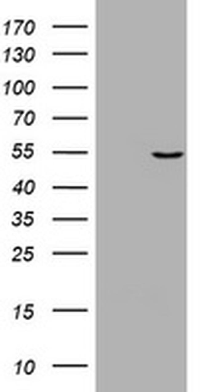 VIM Antibody in Western Blot (WB)