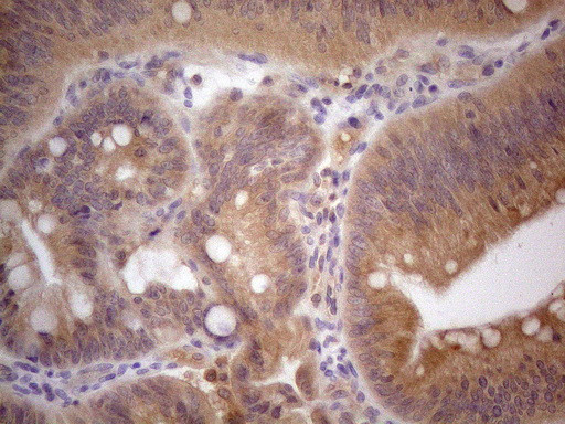VIP Antibody in Immunohistochemistry (Paraffin) (IHC (P))