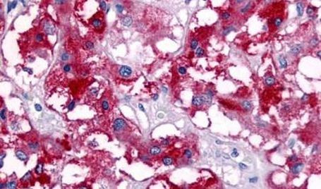 VIPR1 Antibody in Immunohistochemistry (Paraffin) (IHC (P))