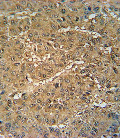 VKORC1 Antibody in Immunohistochemistry (IHC)