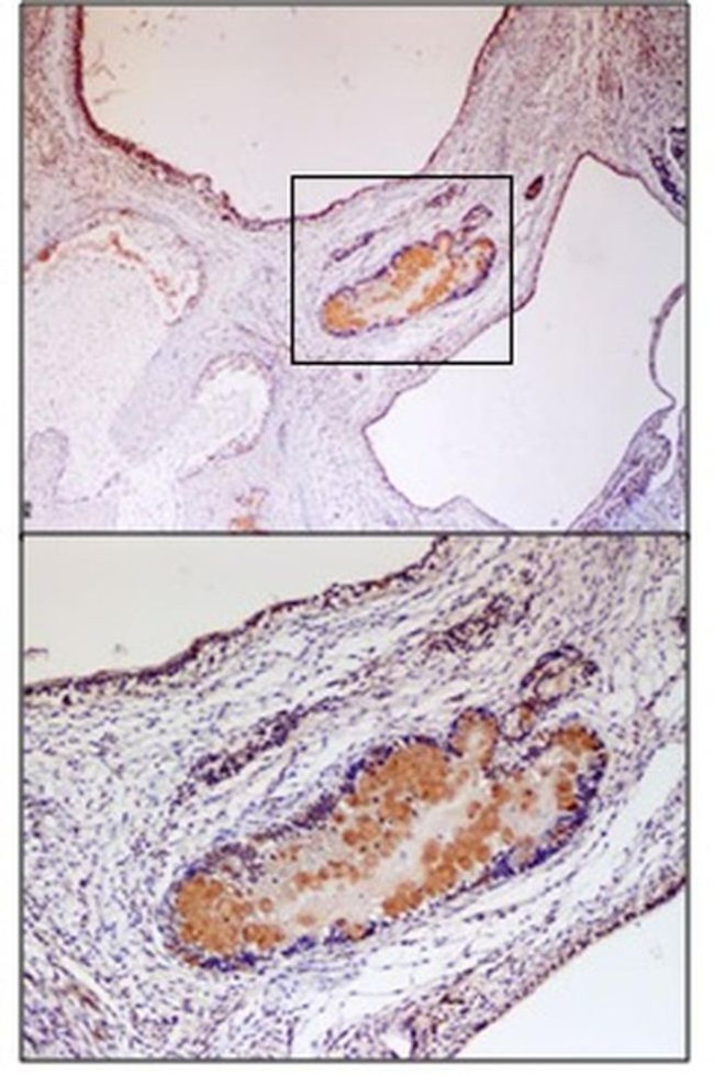 VMAT2 Antibody in Immunohistochemistry (IHC)
