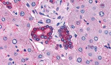 VPAC2 Antibody in Immunohistochemistry (Paraffin) (IHC (P))