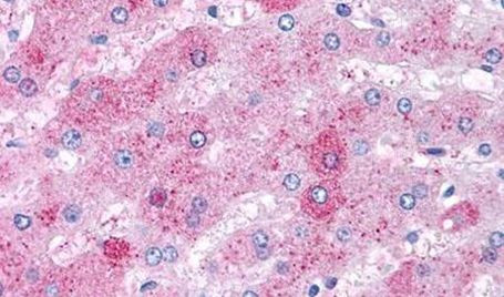 VPAC2 Antibody in Immunohistochemistry (Paraffin) (IHC (P))