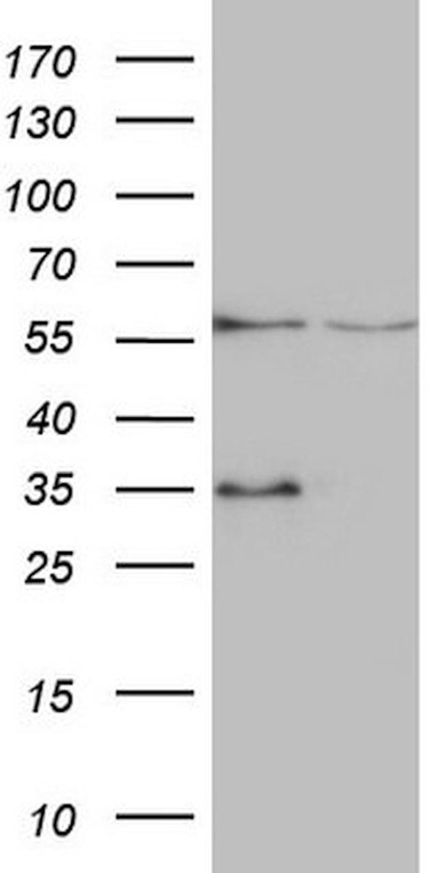 VPS13B Antibody in Western Blot (WB)