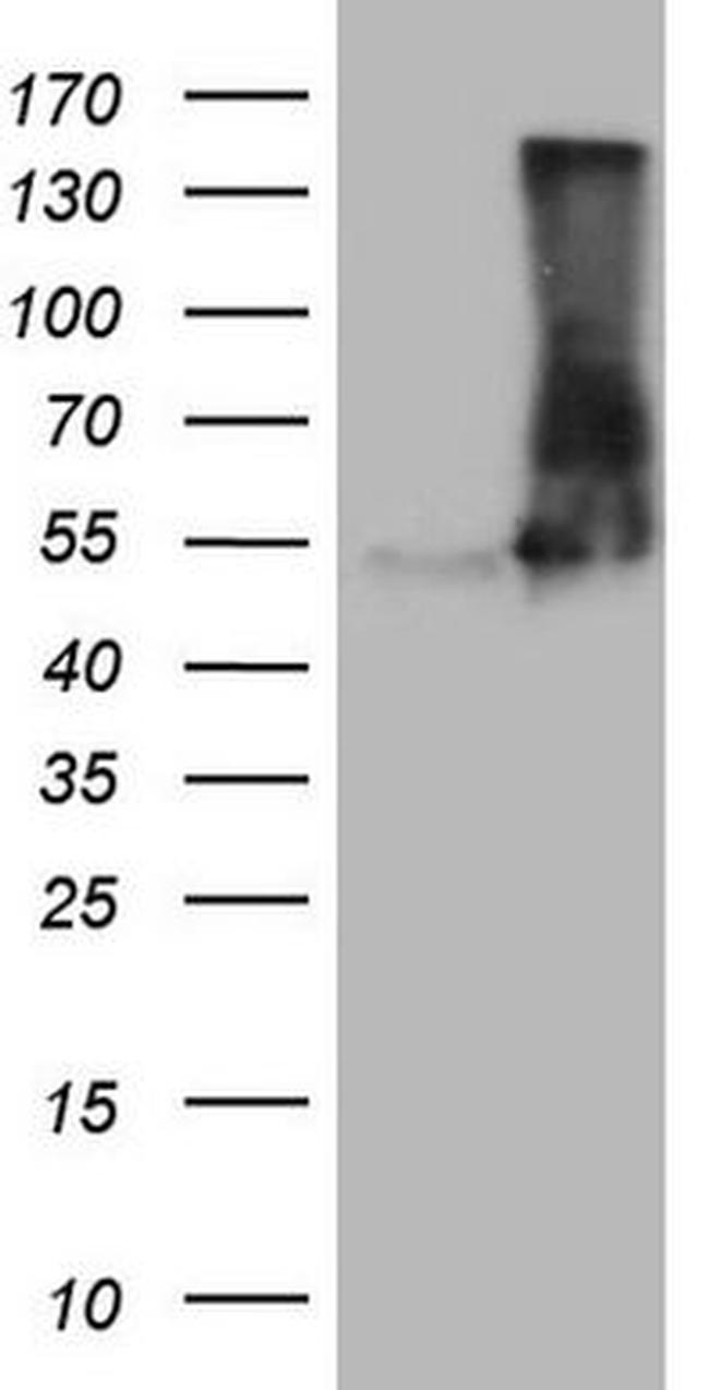 VPS13B Antibody in Western Blot (WB)