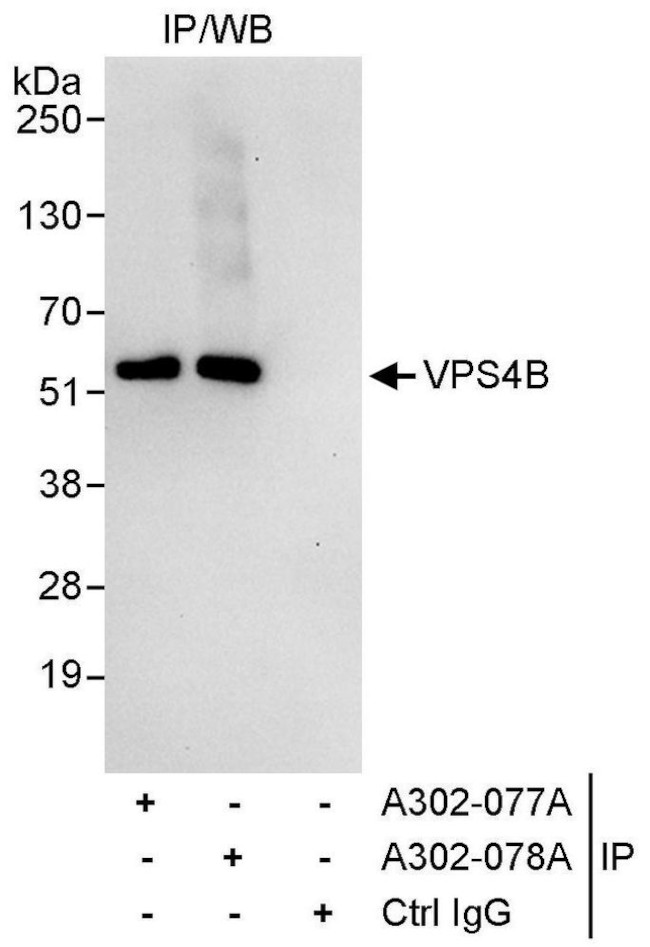 VPS4B Antibody in Immunoprecipitation (IP)