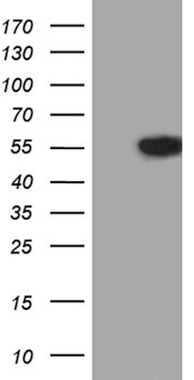 VRK2 Antibody in Western Blot (WB)