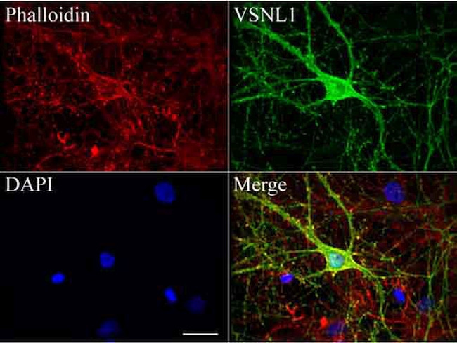 VSNL1 Antibody in Immunocytochemistry (ICC/IF)