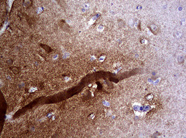 VSNL1 Antibody in Immunohistochemistry (Paraffin) (IHC (P))
