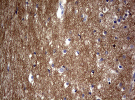 VSNL1 Antibody in Immunohistochemistry (Paraffin) (IHC (P))
