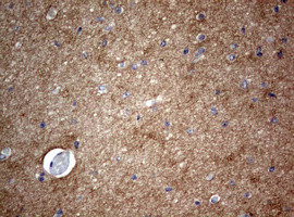 VSNL1 Antibody in Immunohistochemistry (Paraffin) (IHC (P))