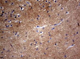 VSNL1 Antibody in Immunohistochemistry (Paraffin) (IHC (P))