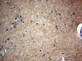 VSNL1 Antibody in Immunohistochemistry (Paraffin) (IHC (P))