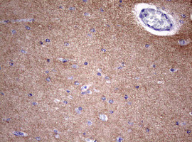 VSNL1 Antibody in Immunohistochemistry (Paraffin) (IHC (P))