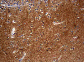 VSNL1 Antibody in Immunohistochemistry (Paraffin) (IHC (P))