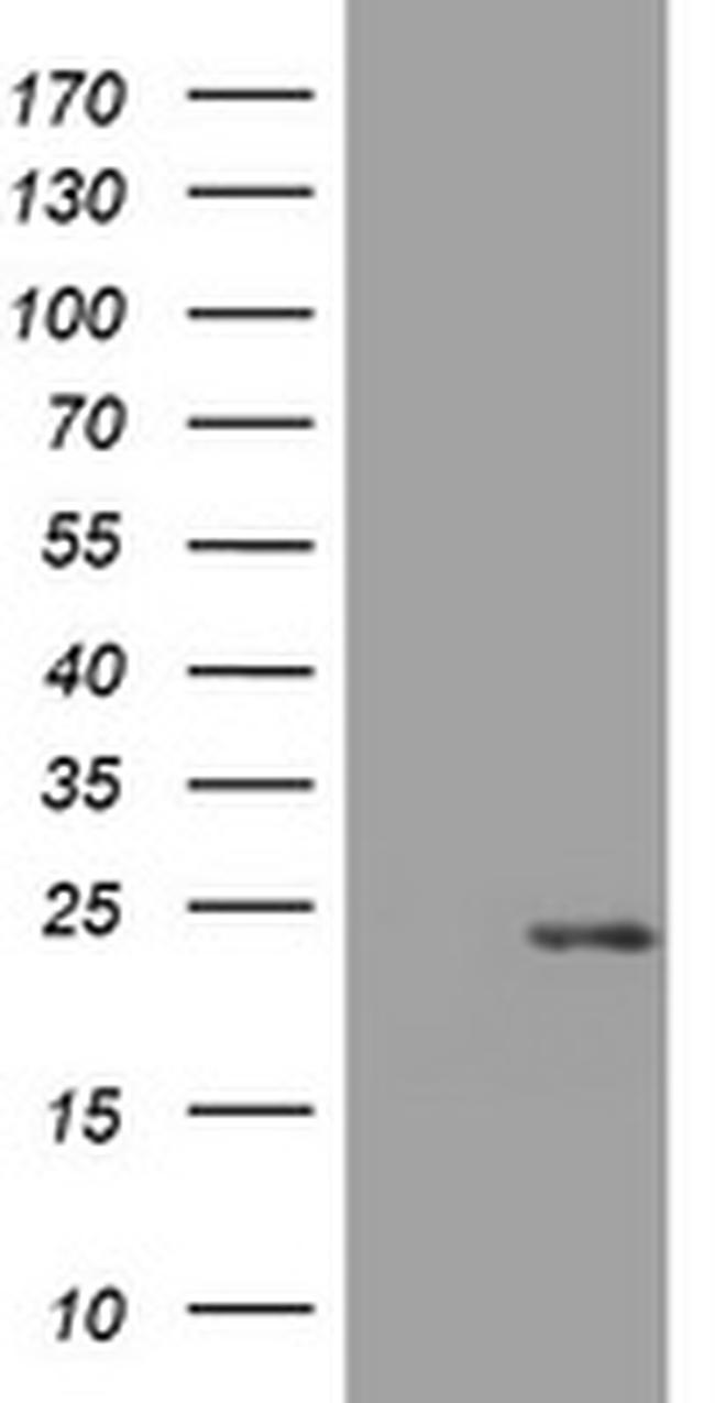 VSNL1 Antibody in Western Blot (WB)