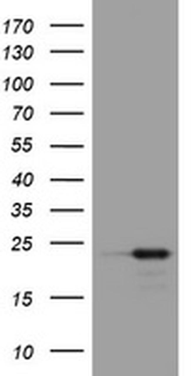 VSNL1 Antibody in Western Blot (WB)