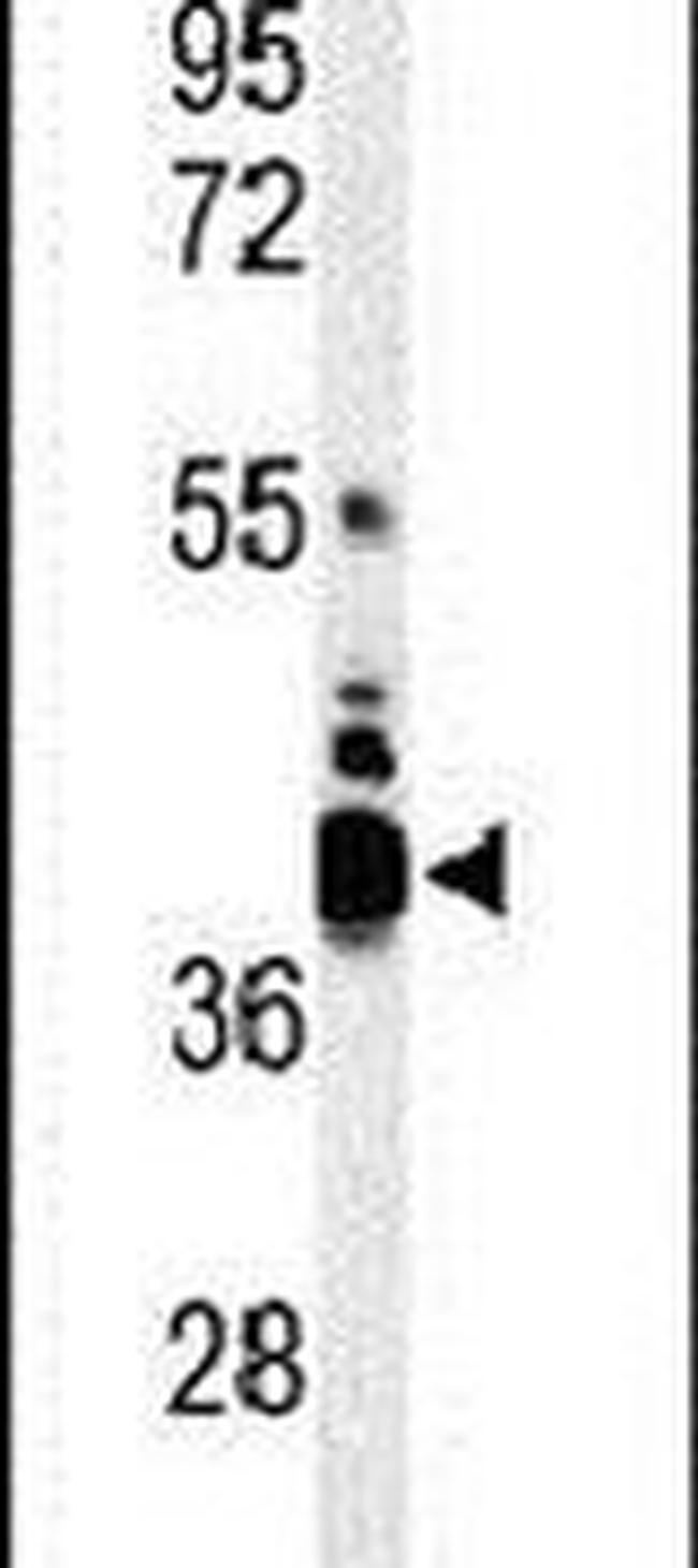 B7-H4 Antibody in Western Blot (WB)