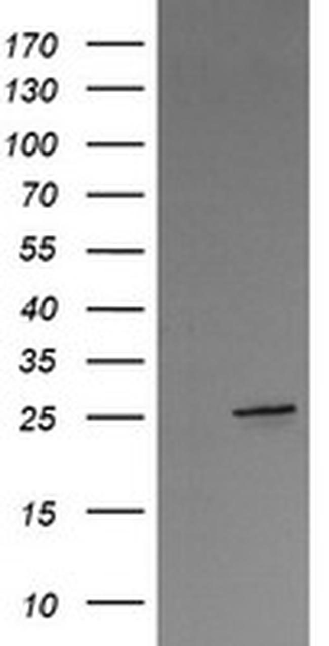 VTI1A Antibody in Western Blot (WB)
