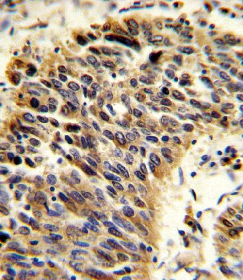 Vitronectin Antibody in Immunohistochemistry (IHC)