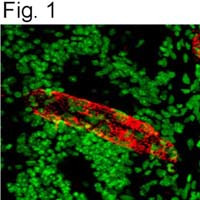 VWF Antibody in Immunohistochemistry (IHC)