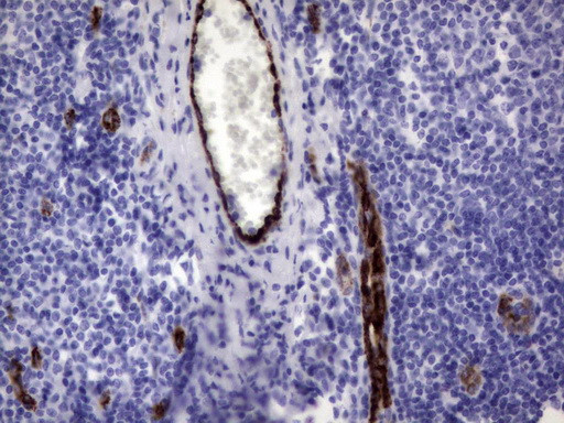 VWF Antibody in Immunohistochemistry (Paraffin) (IHC (P))