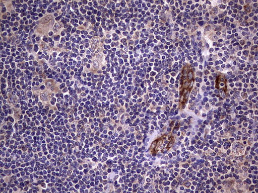 VWF Antibody in Immunohistochemistry (Paraffin) (IHC (P))
