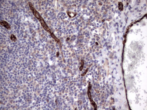 VWF Antibody in Immunohistochemistry (Paraffin) (IHC (P))