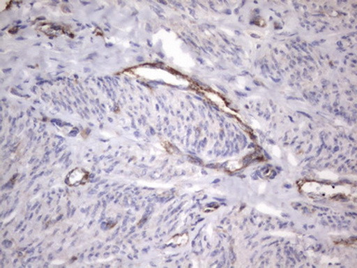 VWF Antibody in Immunohistochemistry (Paraffin) (IHC (P))