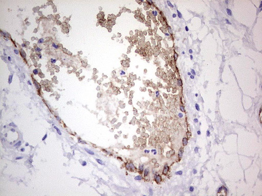 VWF Antibody in Immunohistochemistry (Paraffin) (IHC (P))